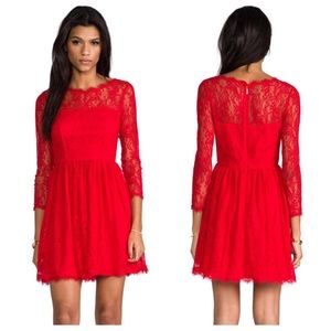 Juicy Couture Dresses & Skirts - Juicy Couture Lace Dress. Juicy Couture Dresses & Skirts - Juicy Couture Lace Dress.
