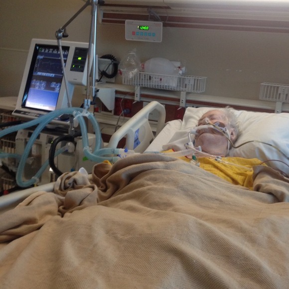 She survived 2-surgeries