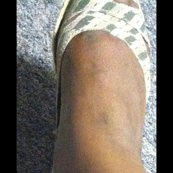 Flats - Picture 2 of 2