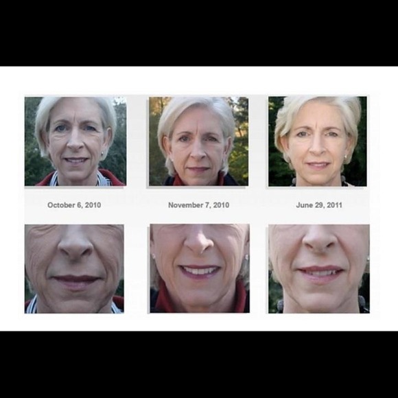 Rodan and fields - Picture 2 of 4
