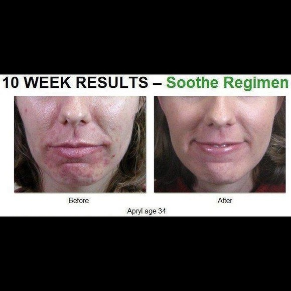 Rodan and fields - Picture 3 of 4