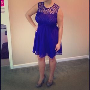 H&M Dresses & Skirts - Gorgeous lace detail dress H&M Dresses & Skirts - Gorgeous lace detail dress
