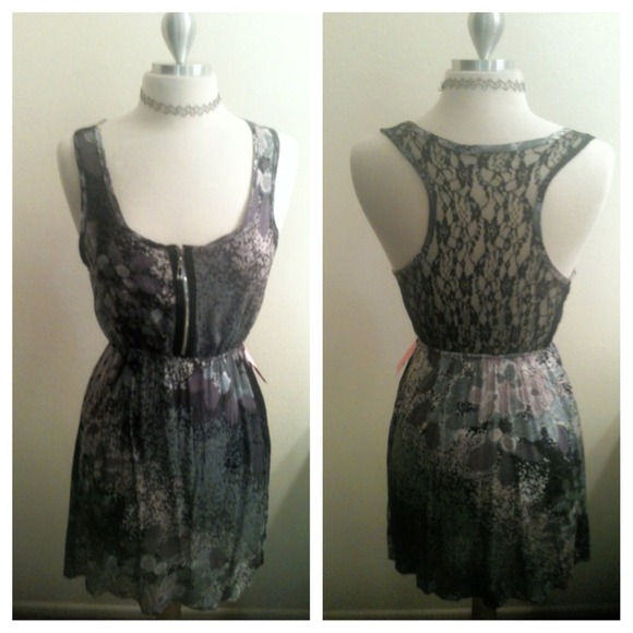 🎈SOLD🎈NWOTS sweet lace racer back zip front