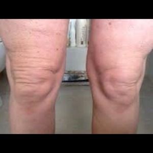 Tightens, tones & firms in 45 minutes