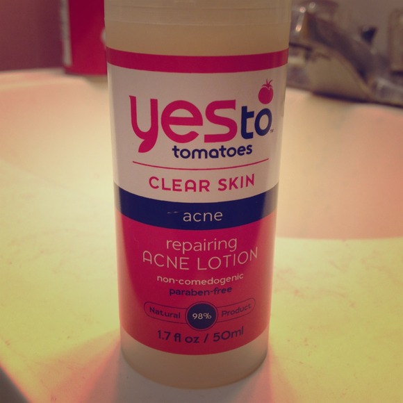 ✨Sold✨Yes to tomatoes acne repairing lotion