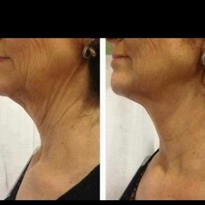 Facial Wraps