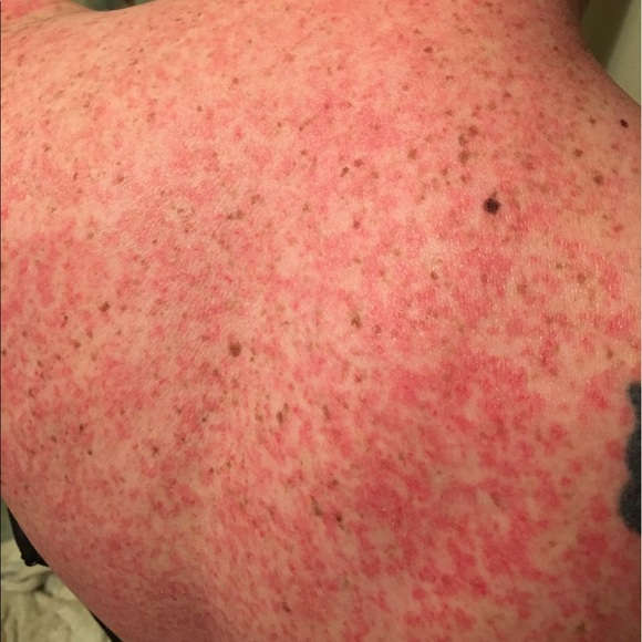 Survivor of 3 autoimmune diseases. JESUS HEALS!Grandkinds (4)an kids (3)! - Picture 4 of 16