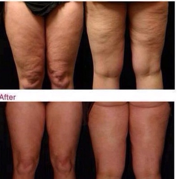 DEFINING GEL- itWorks Global, it REALLY WORKS! - Picture 2 of 4