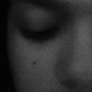 My birthmark. Chocolate brown.