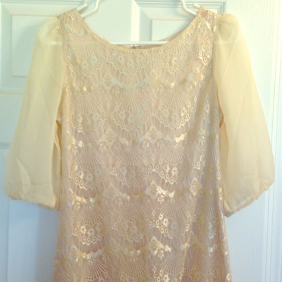 💄Beautiful lace dress