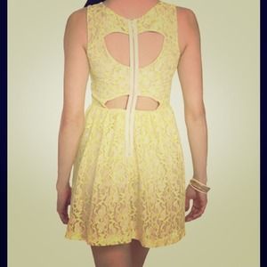 Relisted! Pretty lace dress