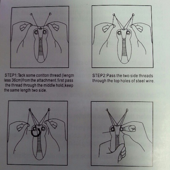 Hair removal - Picture 4 of 4