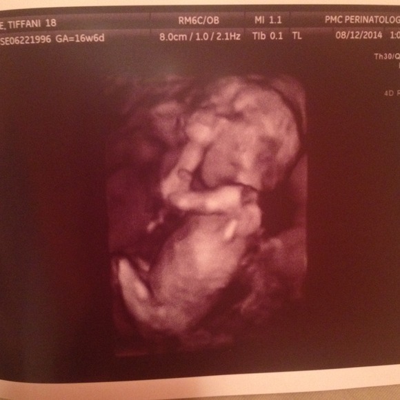 Why I'm selling.... - Picture 4 of 4