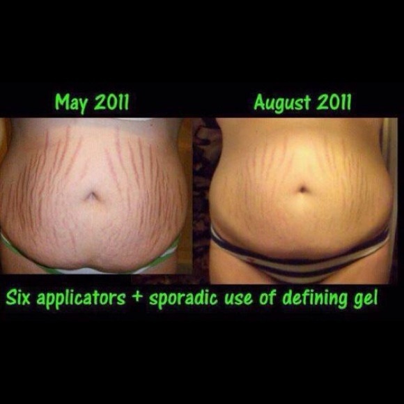 Sold-itworks skinny body wrap for belly fat & scar