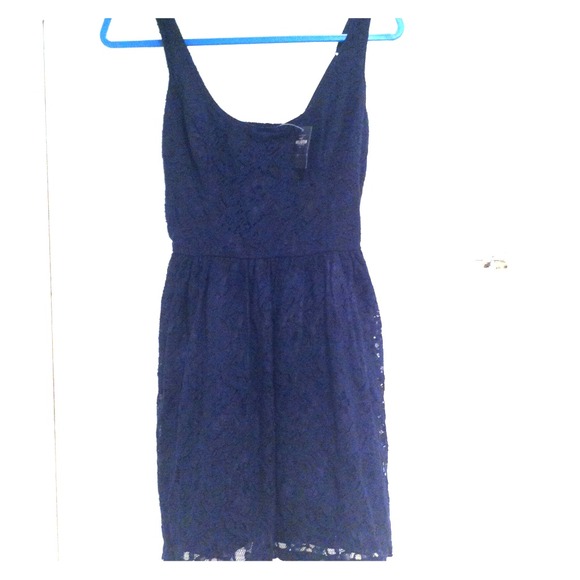 ✨TRADED✨NWT HOLLISTER LACE DRESS