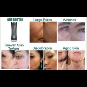 Nerium AD