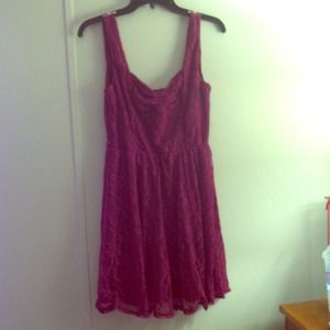 Lace dress!!