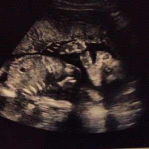 Welcome MarleyRoseSater! <3 :)