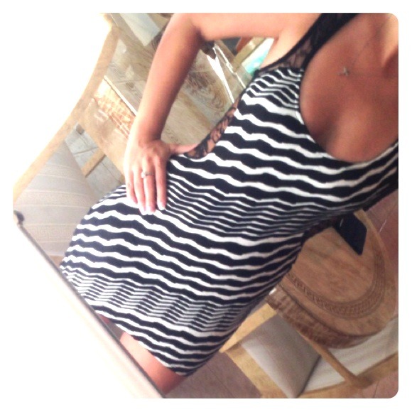 small dress, black && white and lace