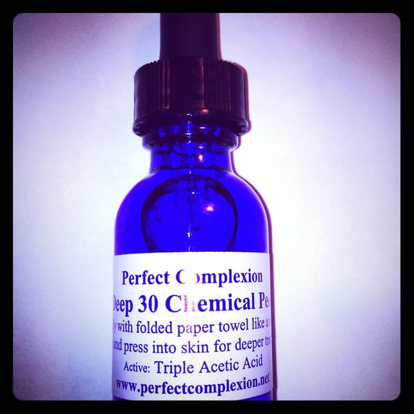 One oz Blue Peel Tca deep 30 Face Peel