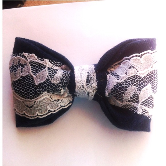 The Lace Hair Bow🎀