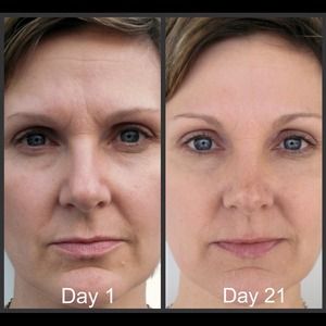 Nerium, NeriumAD, Anti-aging, Night & Day Creams