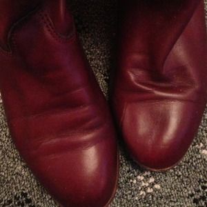 Years wearing these😊it's natural wear & tear