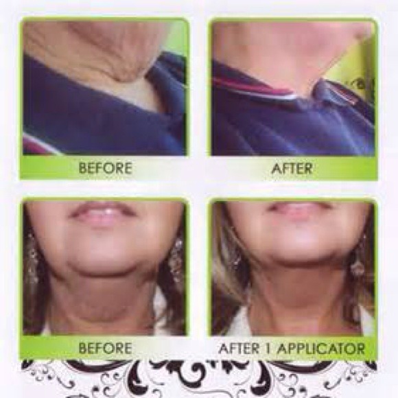 Facial wraps
