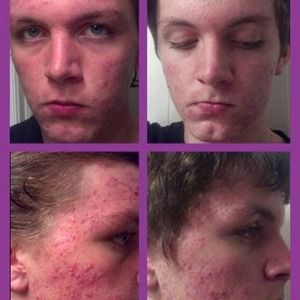 Anti aging serum but so much more!