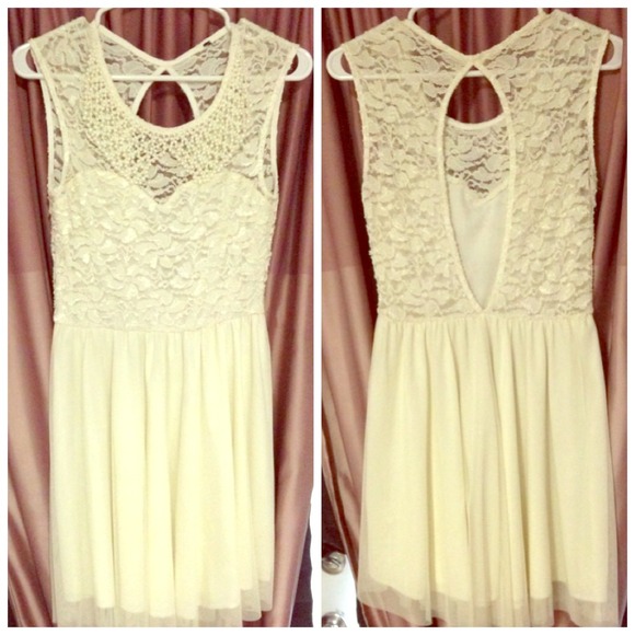 Love Coutoure Dresses & Skirts - Little Lace Dress