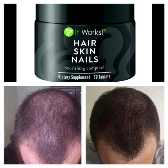 It Works!!!! Don't believe me~Just Try It!!! - Picture 4 of 4