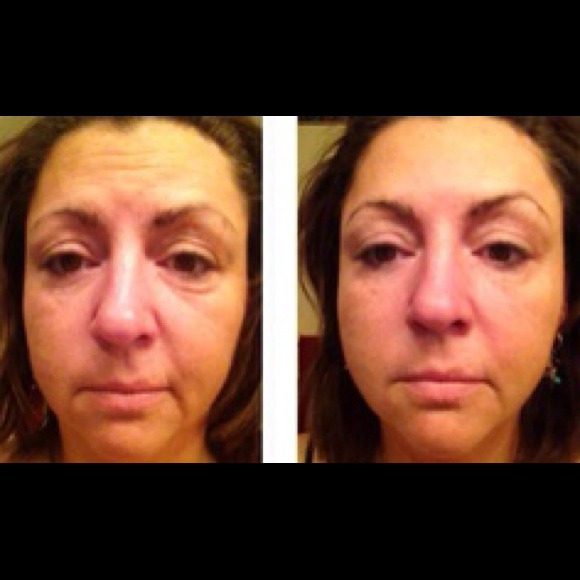 Facial Wrap - Picture 3 of 4