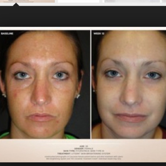 SkinMedica Lytera brightening system - Picture 2 of 2