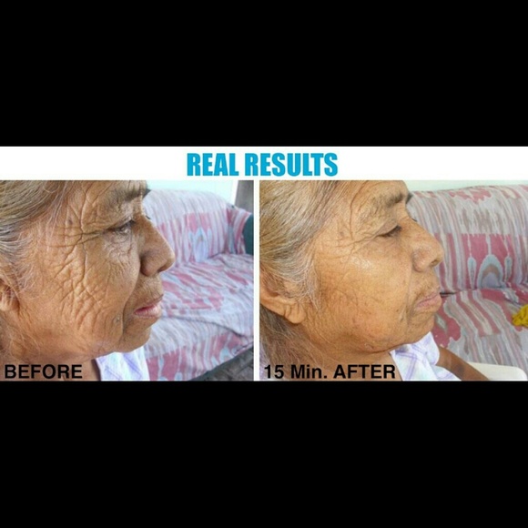 Nanotechnology- Recover Masque - Picture 2 of 4