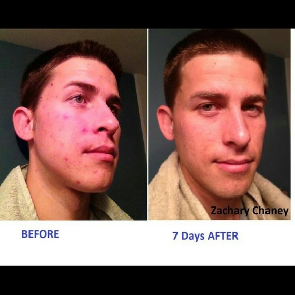 Mud Soap - Picture 2 of 3