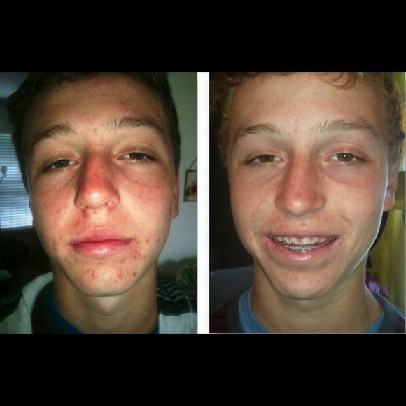 Mud Soap - Picture 3 of 3