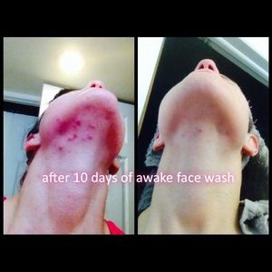 Awake Cleanser results..