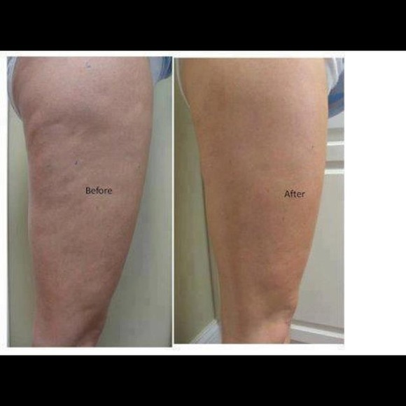 2 Boxes of Skinny Wraps - Picture 4 of 4