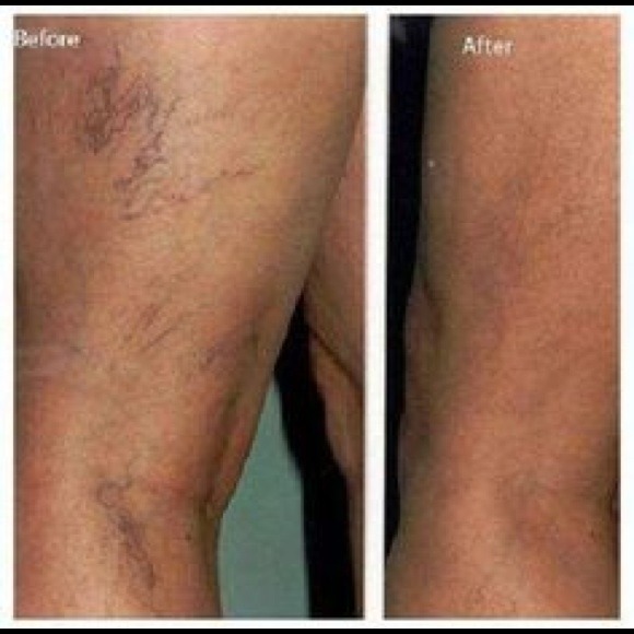 Defining Gel (tattoo brightener) - Picture 2 of 4