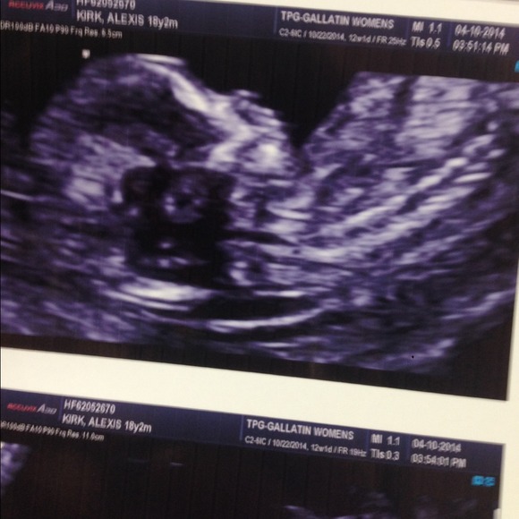 😍 MY FIRST GRANDBABY!!