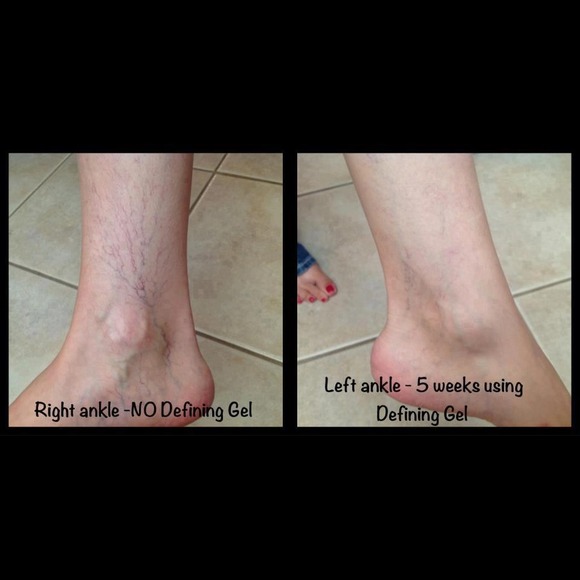 Defining Gel- wrinkle,varicose veins, cellulite - Picture 3 of 3
