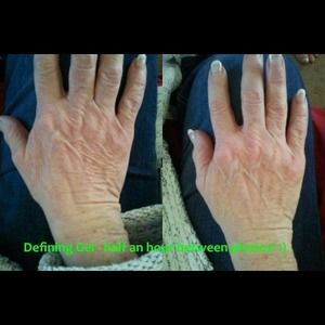 Defining Gel- wrinkle,varicose veins, cellulite