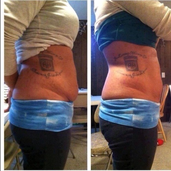 Body wraps - Picture 1 of 2