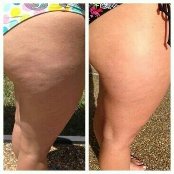 Nerium FIRM SkinTighteningTreatment - Picture 3 of 4