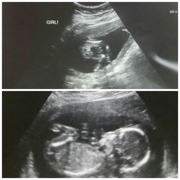 It's a girl! :)