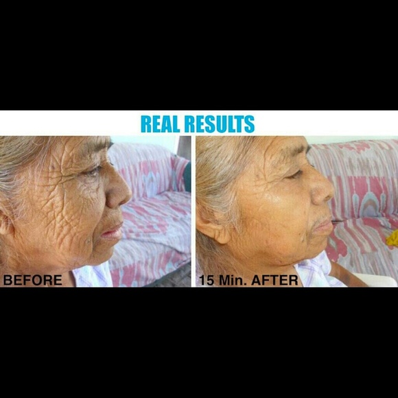 Anti-aging Recover Mask - Picture 3 of 4