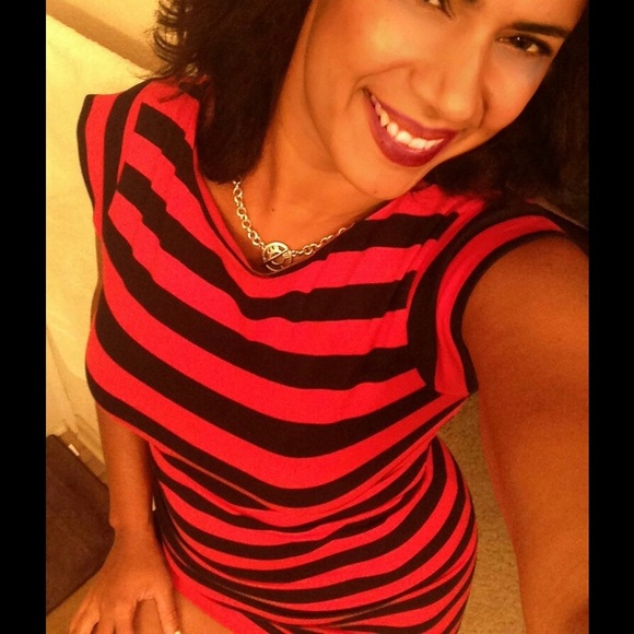 French Connection striped dress - Picture 1 of 3