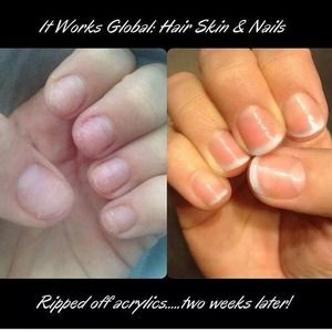 Hair skin and nails 💚💚💚💚