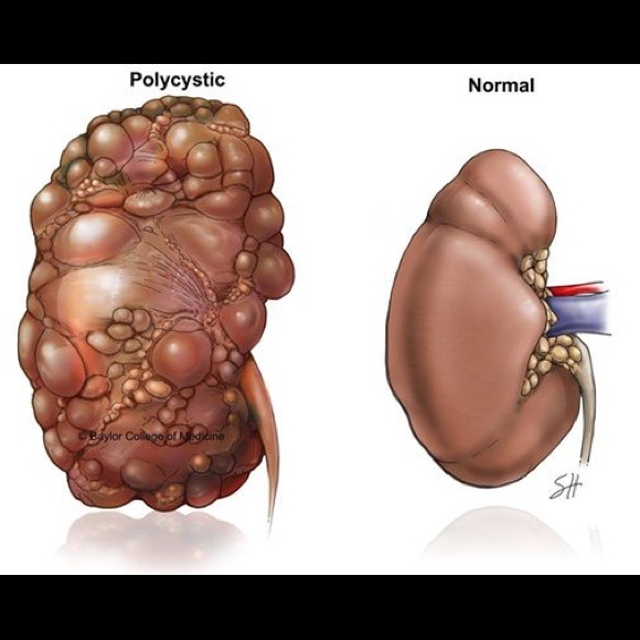 SHARE to spread awareness - Picture 3 of 4