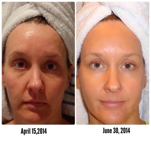 Rodan and Fields Skincare> brittberry@myrandf.com - Picture 3 of 4